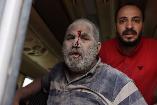 An injured man is covered in dust in the aftermath of Israeli bombing in Rafah, southern Gaza, on October 29.