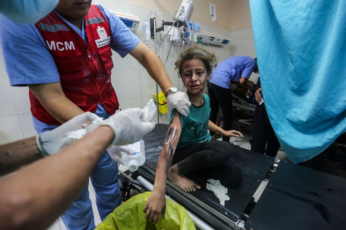KHAN YUNIS, GAZA - NOVEMBER 7: (EDITOR'S NOTE: Image depicts graphic content) A Palestinian child receives treatment after Israeli air raids at Nasser Medical Hospital on November 7, 2023 in Khan Yunis, Gaza. Heavy fighting rages in the northern Gaza Strip as Israel encircles the area, despite increasingly pressing calls for a humanitarian truce. The leaders of the main UN agencies issued a rare joint statement to express their indignation. More than 40 per cent of the dead in Gaza after nearly four weeks of war are children. (Photo by Ahmad Hasaballah/Getty Images)