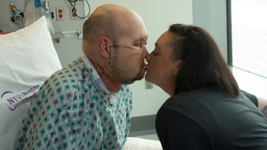Aaron James, 46, and wife Meagan kiss for the first time following his transplant surgery.