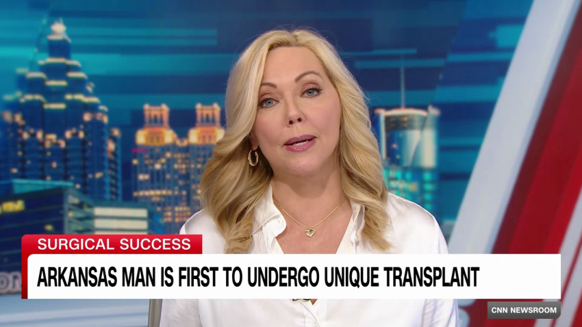 exp First Whole Eye Transplant Jimenez PKG 111302ASEG2 CNNi Health_00000817.png