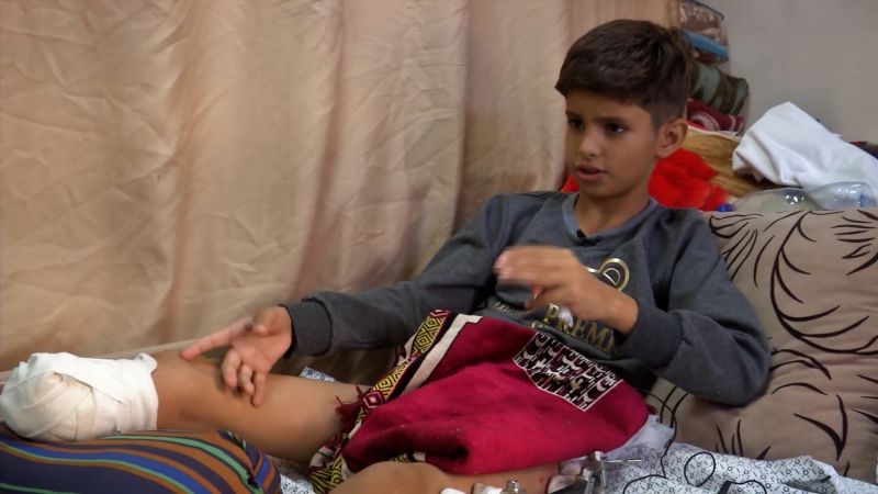 Children without limbs, children without parents: Jomana Karadsheh visits Gaza’s wounded kids | CNN