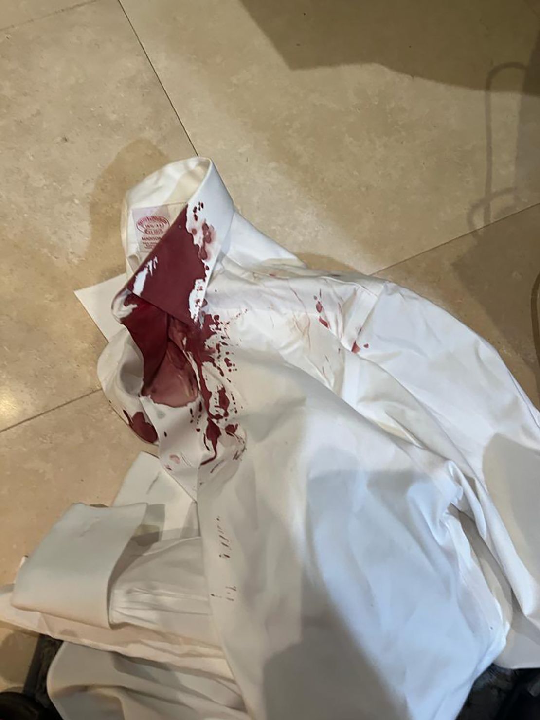 A photo shows the bloody shirt of a man who was attacked in what authorities believe is an antisemitic hate crime. 75-year-old victim, Raphal "Raphy" Nissel, told CNN he and his wife were walking to their synagogue Saturday morning when a man came up behind him and hit him in the head with an object. His wife, Rebecca Nissel, recalled the man saying, "Give me your earrings, Jew."