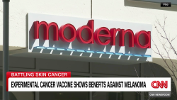 exp cancer vaccine melanoma expert interview 121501ASEG1 cnni health_00003201.png