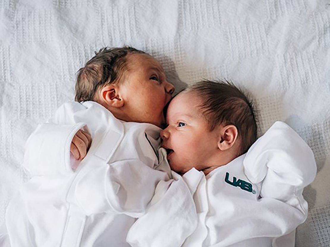 Kelsey Hatcher gave birth to two girls after becoming pregnant in her rare double uteri earlier this year. Left: Baby A, named Roxi, was delivered vaginally on Dec. 19 at 7:45 p.m. weighing 7 pounds 7 ounces. Right: Baby B, named Rebel, was delivered via c-section on Dec. 20 at 6:10 a.m. weighing 7 pounds 3.5 ounces.