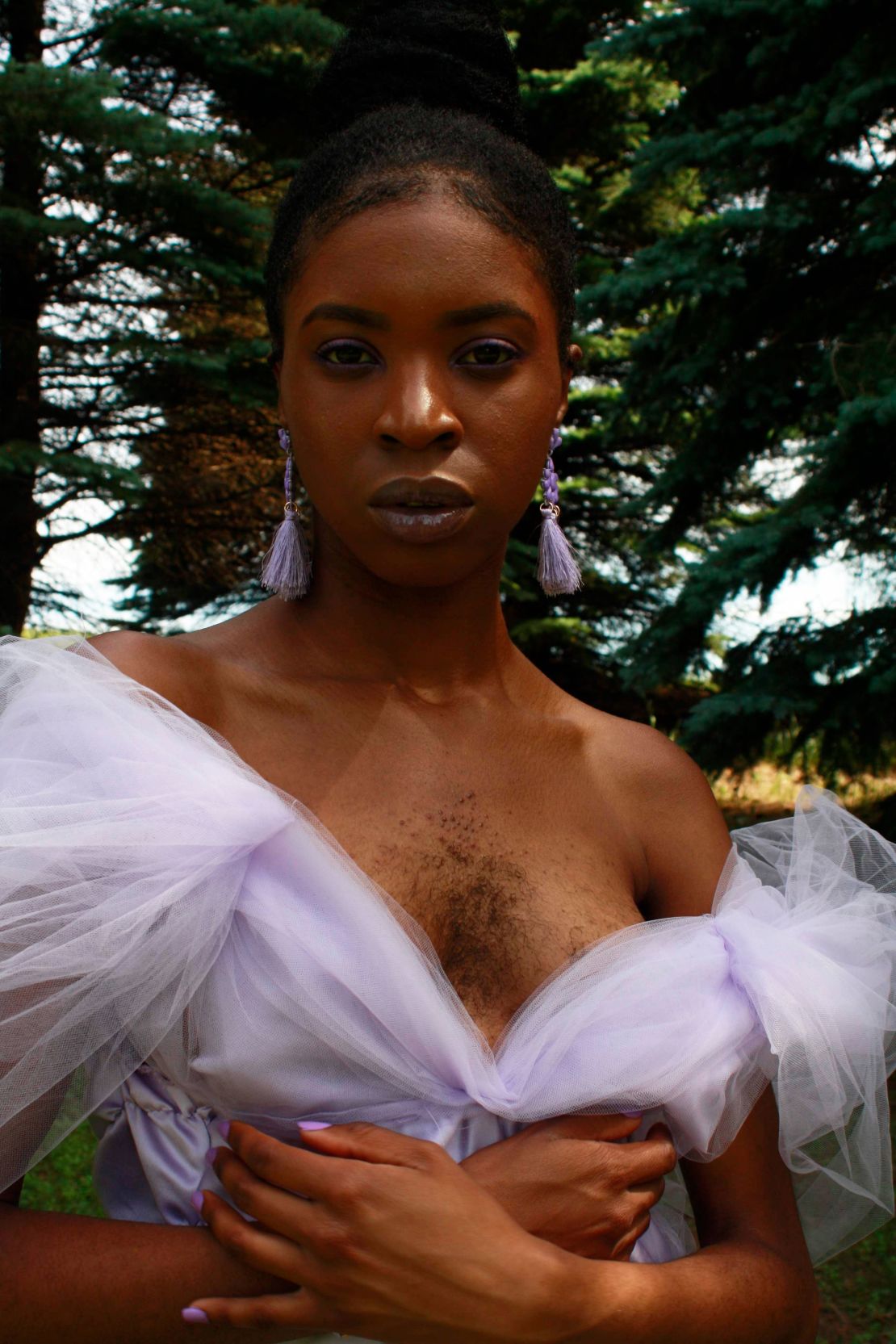 Artist Esther Calixte-Bea said she regularly receives hate and abuse from strangers for letting her body hair grow. 