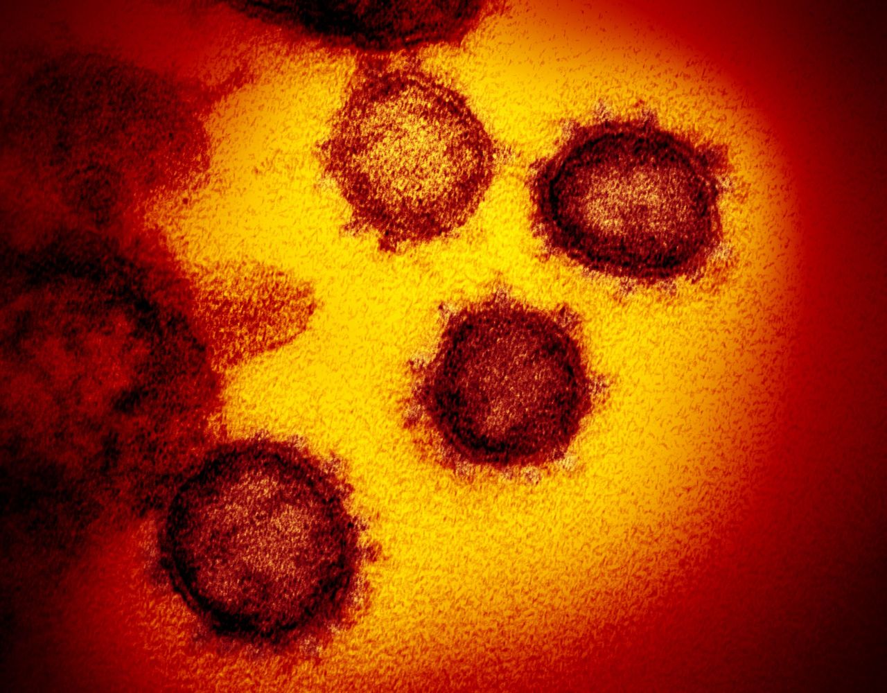 Coronaviruses?are a large group of viruses common among animals.