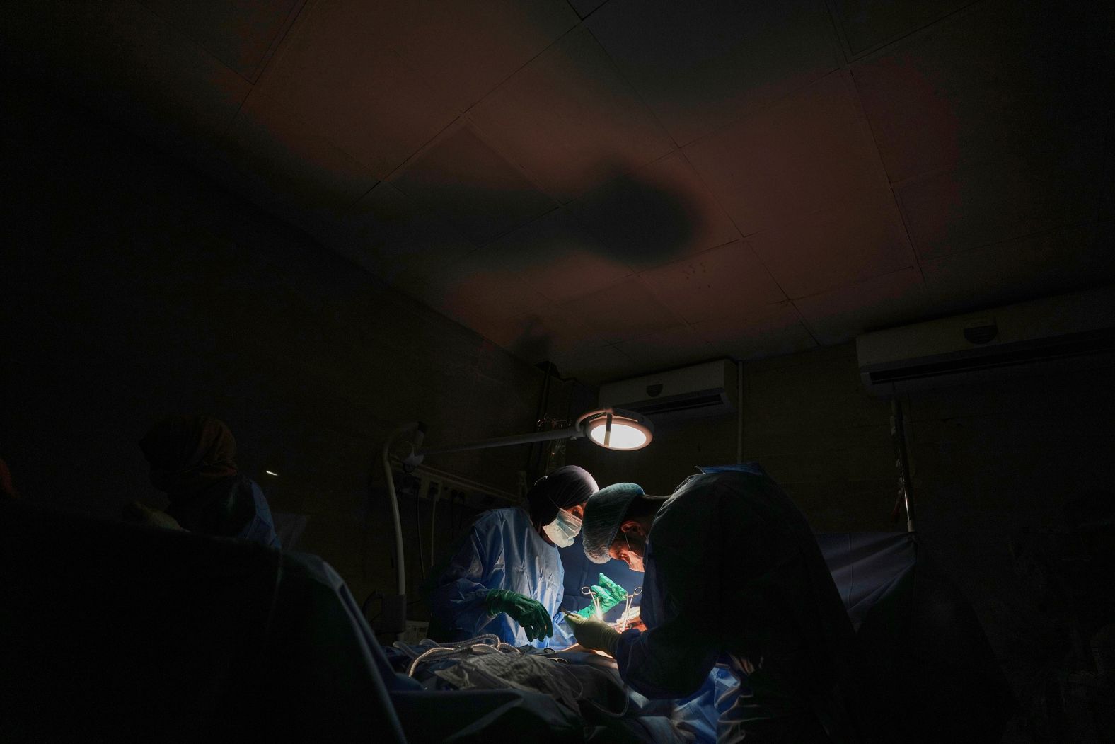 Dr. Abeer Al-Gharbawi, left, performs surgery under the illumination of a battery-powered light during a power outage at the Shifa Hospital in Gaza City on Friday, July 4. Hospitals in Gaza say that <a href="index.php?page=&url=https%3A%2F%2Fwww.cnn.com%2F2025%2F07%2F09%2Fmiddleeast%2Fgaza-fuel-babies-incubator-intl">fuel shortages</a> are forcing them to shut off vital services, putting patients’ lives at risk.