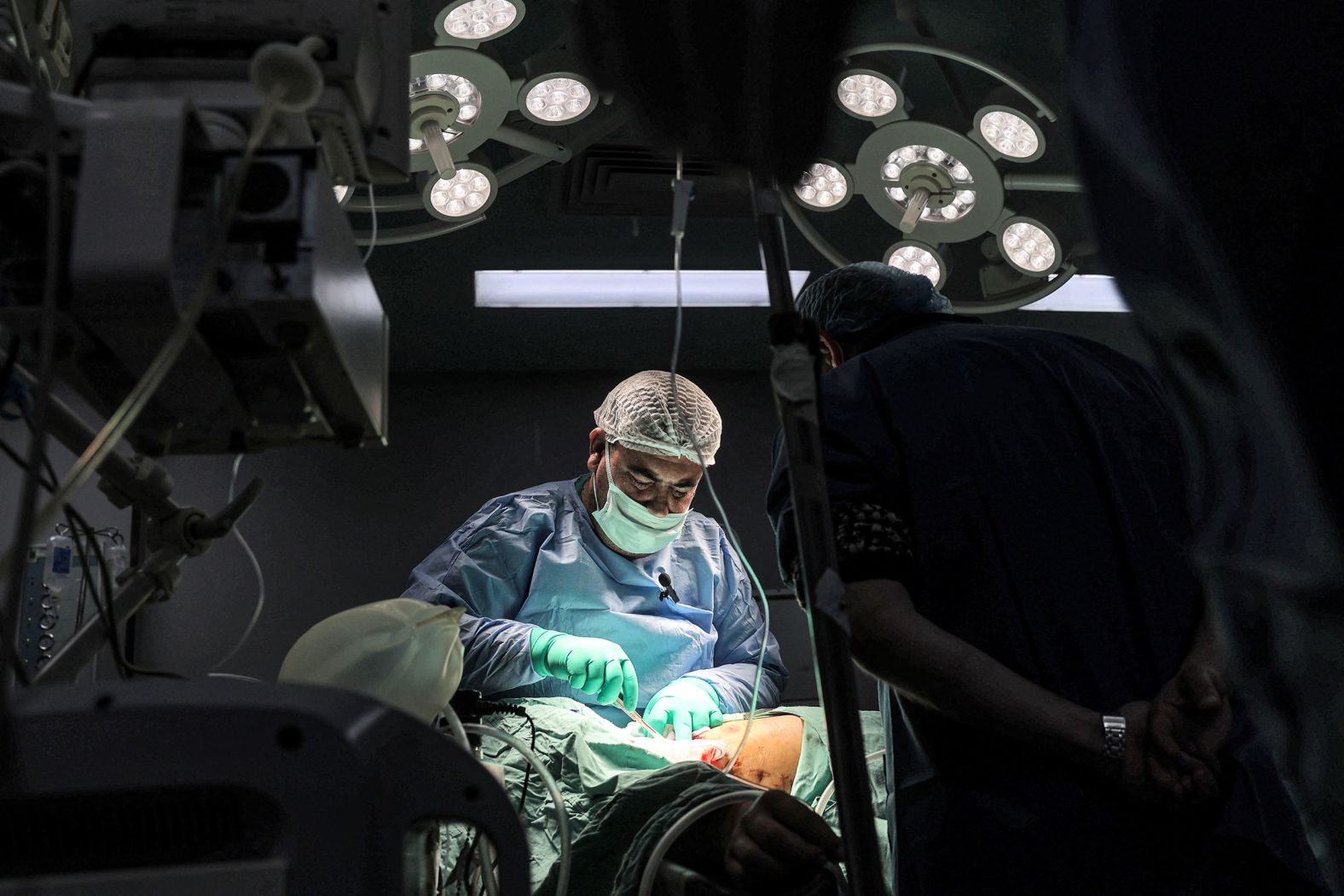 A surgeon operates on a patient at the European Hospital in Khan Younis, Gaza, on Sunday, December 31. The southern city has been a hot spot in the fighting between Israel and Hamas.