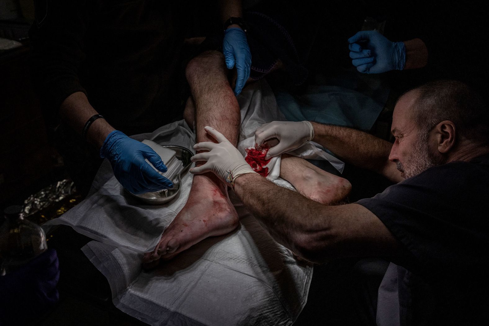 A Ukrainian soldier with a bullet wound to his leg receives treatment near the front lines of the war against Russia on Monday, January 8.