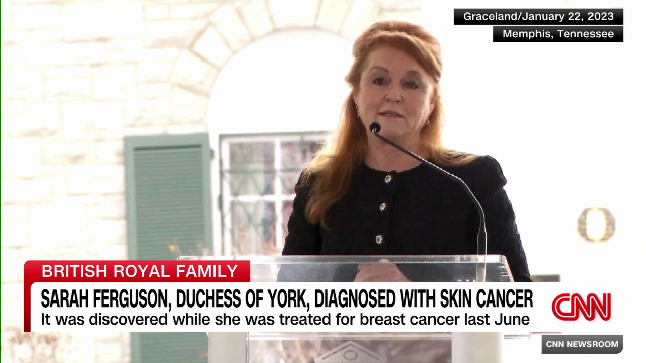 exp Sarah ferguson duchess of york health skin cancer max foster live 012203aseg2 cnni world_00002018.png