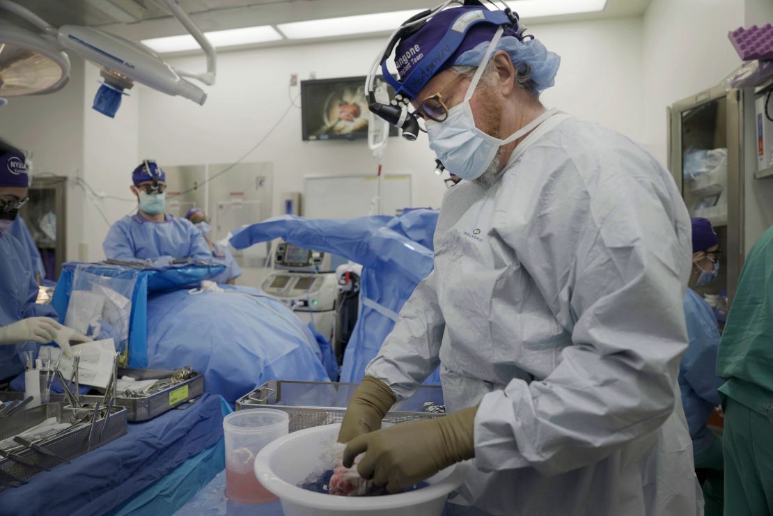 Dr. Robert Montgomery, director of NYU Langone's transplant institute, prepares a pig kidney for transplant into a brain-dead man in New York on July 14, 2023. Researchers around the country are racing to learn how to use animal organs to save human lives. (AP Photo/Shelby Lum)