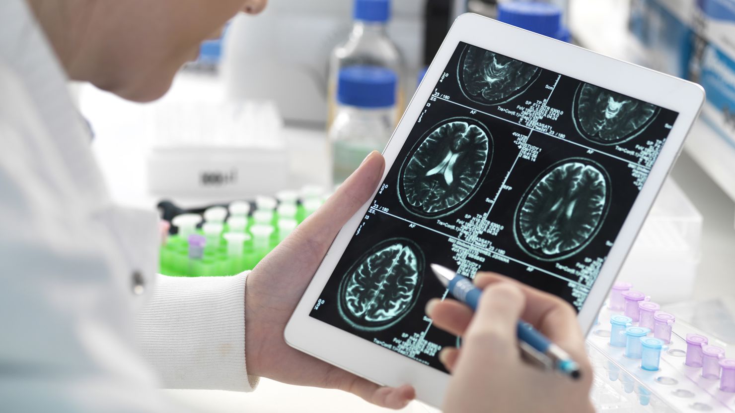 Doctor viewing patient's brain scan on digital tablet in laboratory - stock photo