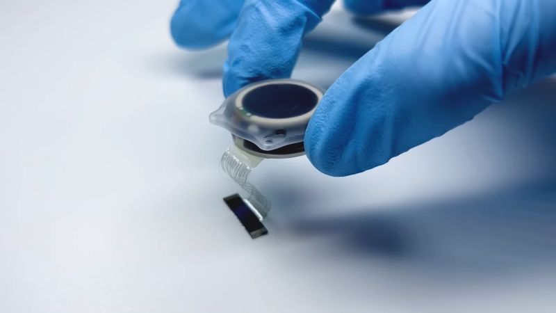 Musk startup implanted a brain chip into a human. Gupta explains how it works