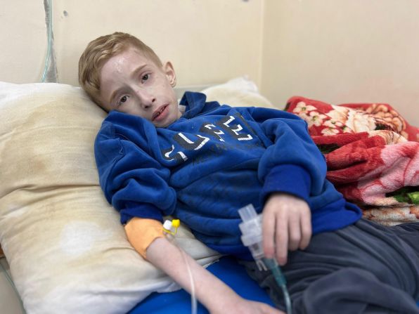 Fadi Al-Zanat, 6, is treated at the Kamal Adwan Hospital in northern Gaza on March 10. <a href="https://www.cnn.com/middleeast/live-news/israel-hamas-war-gaza-news-03-13-24/h_7d375bcf507818a9bd1eebfff61e8730" target="_blank">He was suffering from severe malnutrition and dehydration</a>, according to the health ministry in Gaza.
