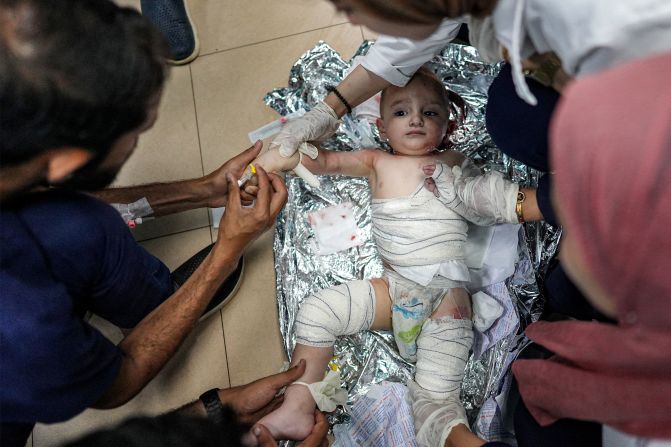 Medics tend to an injured infant at a hospital in Deir El-Balah, Gaza, following an Israeli bombardment in the Bureij area on Tuesday, June 4. The Israeli military <a href="https://www.cnn.com/2024/06/04/middleeast/israel-assault-bureij-gaza-intl-latam/index.html" target="_blank">launched a new ground and air assault in central Gaza on Tuesday</a> as it ramped up attacks in its war against Hamas.