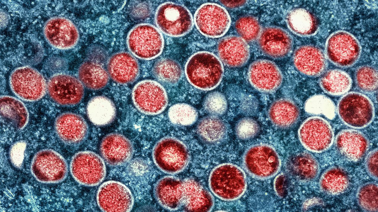 This is a colorized transmission electron microscopic image of mpox virus particles (red), found within an infected cell (blue), that had been cultured in the laboratory. The image was captured and color-enhanced at the National Institute of Allergy and Infectious Diseases (NIAID), Integrated Research Facility (IRF), located in Fort Detrick, Maryland.