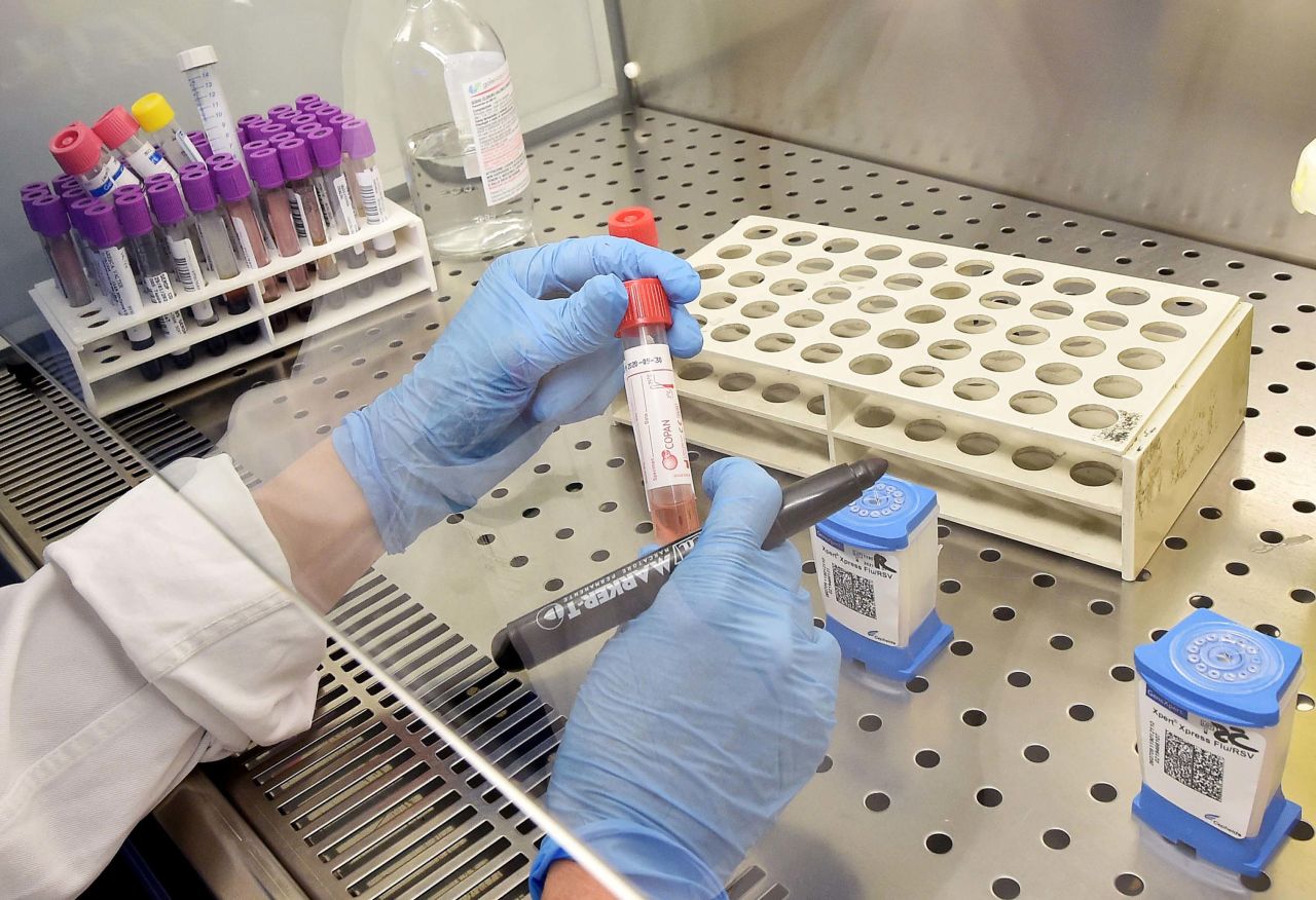 A laboratory assistant prepares a test for the coronavirus at the Amedeo di Savoia hospital in Turin, Italy on January 30.