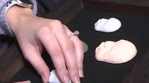 3D printed ultrasound allows mom with visual impairment to ‘see’ baby