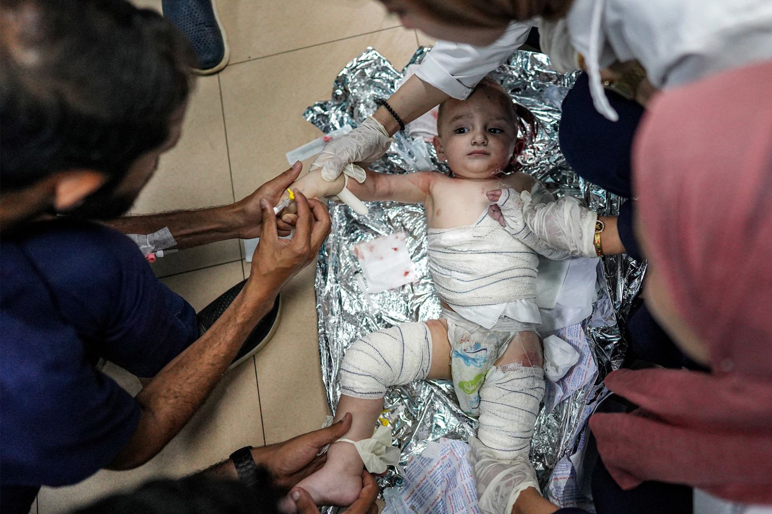 Medics tend to an injured infant at a hospital in Deir al-Balah, Gaza, following an Israeli bombardment in the Bureij area on June 4. The Israeli military <a href="https://www.cnn.com/2024/06/04/middleeast/israel-assault-bureij-gaza-intl-latam/index.html">launched a new ground and air assault in central Gaza</a> as it ramped up attacks in its war against Hamas.