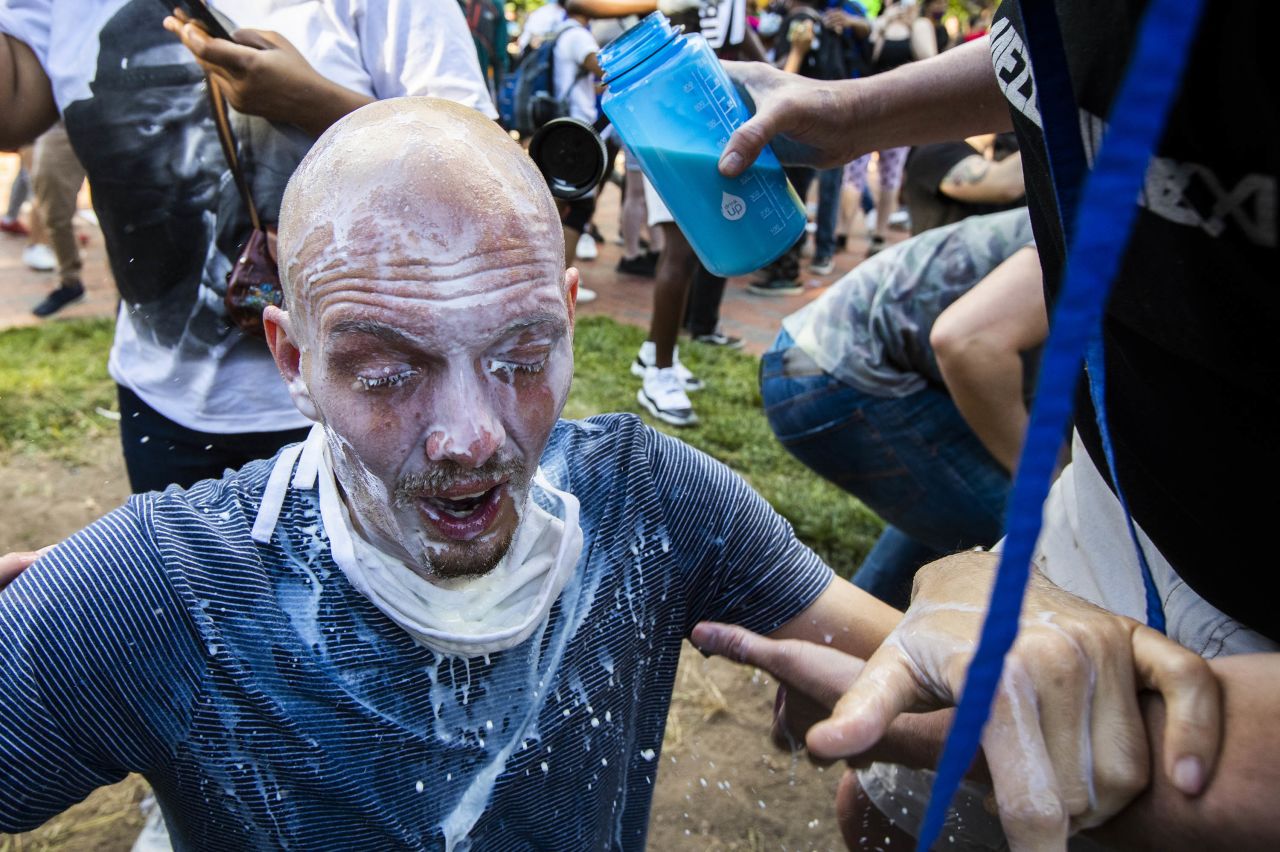 Milk is poured into a demonstrator's eyes to neutralize the effect of pepper spray during a rally at Lafayette Park near the White House in Washington D.C., on Sunday, May 31. 