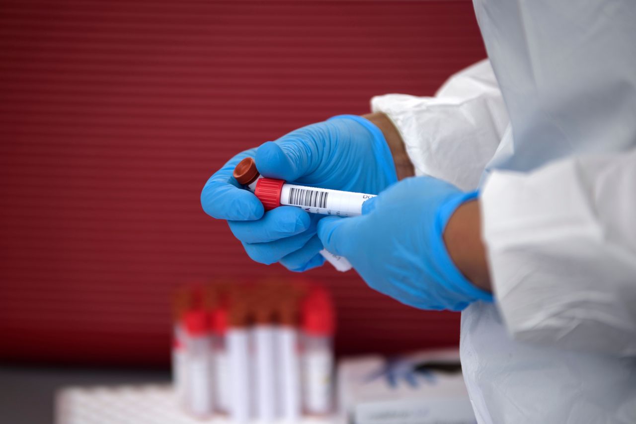 A health care worker organizes Covid-19 tests that were just administered at a testing site in Houston on June 25.