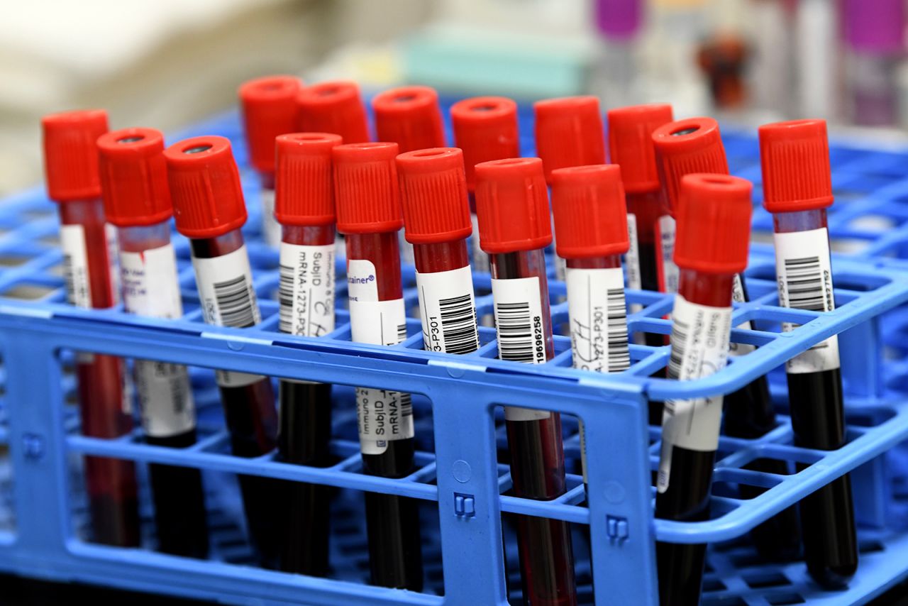 In this Sept. 2, 2020 file photo, blood samples from volunteers participating in the last-stage testing of the Covid-19 vaccine by Moderna and the National Institutes wait to be processed in a lab at the University of Miami Miller School of Medicine in Miami. 