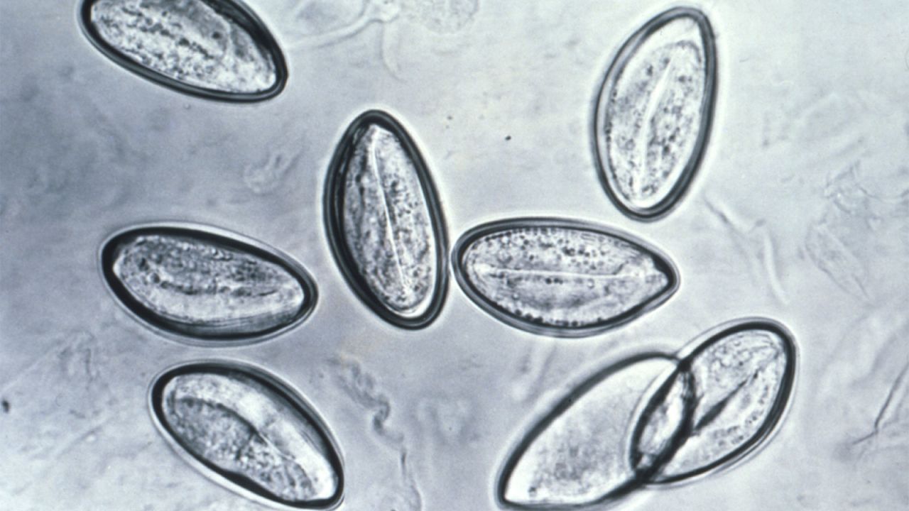 This photomicrograph depicts eight eggs of the human pinworm, <em>Enterobius vermicularis</em>, which had been mounted on cellulose tape. Eggs are deposited on perianal folds. Self-infection occurs by transferring nematode eggs to the mouth with hands that have scratched the perianal area. Person-to-person transmission can also occur through handling of contaminated clothes or bed linens.