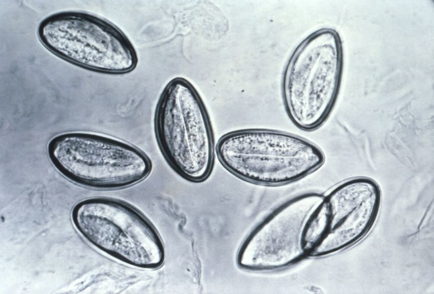 The pinworm is the most common intestinal parasitic worm in the United States.