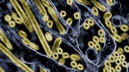 在Madin-Darby犬肾（MDCK）上皮细胞中生长的甲型H5N1禽流感病毒颗粒（金）的彩色透射电子显微照片。