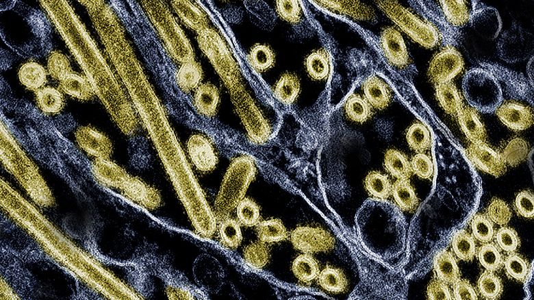 Colorized transmission electron micrograph of avian influenza A H5N1 virus particles (gold), grown in Madin-Darby Canine Kidney (MDCK) epithelial cells.