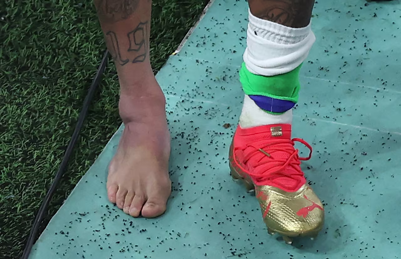 Neymar's swollen ankle as he leaves the field.