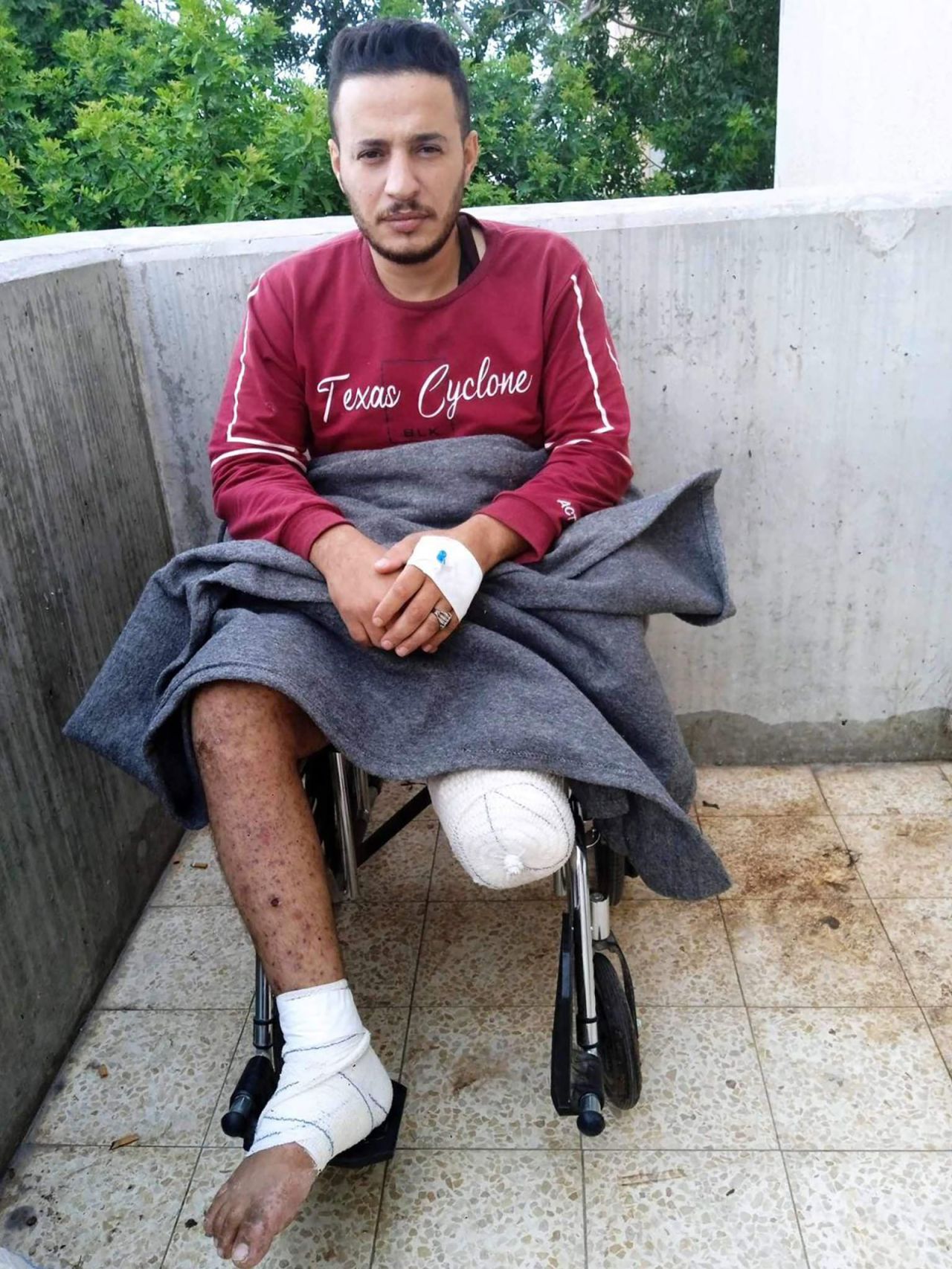 Muhammad Hassan Abu Watfa in Khan Younis, Gaza, last month. He was severely wounded by a strike while trying to buy bread in the Sheikh Radwan neighborhood, in northern Gaza, on October 16. His right foot was amputated twice.