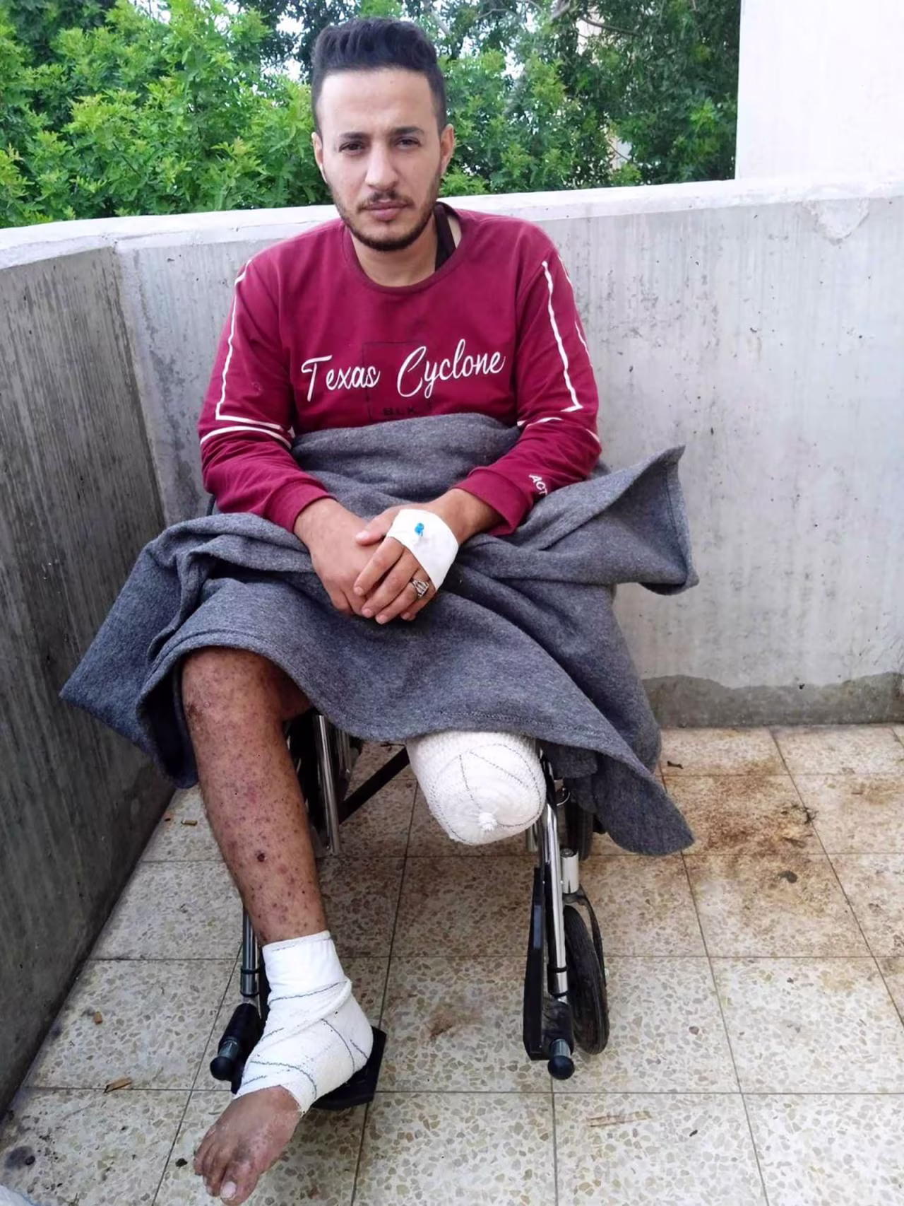 Muhammad Hassan Abu Watfa in Khan Younis, Gaza, last month. He was severely wounded by a strike while trying to buy bread in the Sheikh Radwan neighborhood, in northern Gaza, on October 16. His right foot was amputated twice.