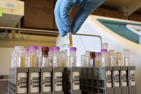 Researchers at the UW Medicine Retrovirology Lab at Harborview Medical Center work on samples from the Novavax phase 3 Covid-19 clinical vaccine trials on February 12 in Seattle.