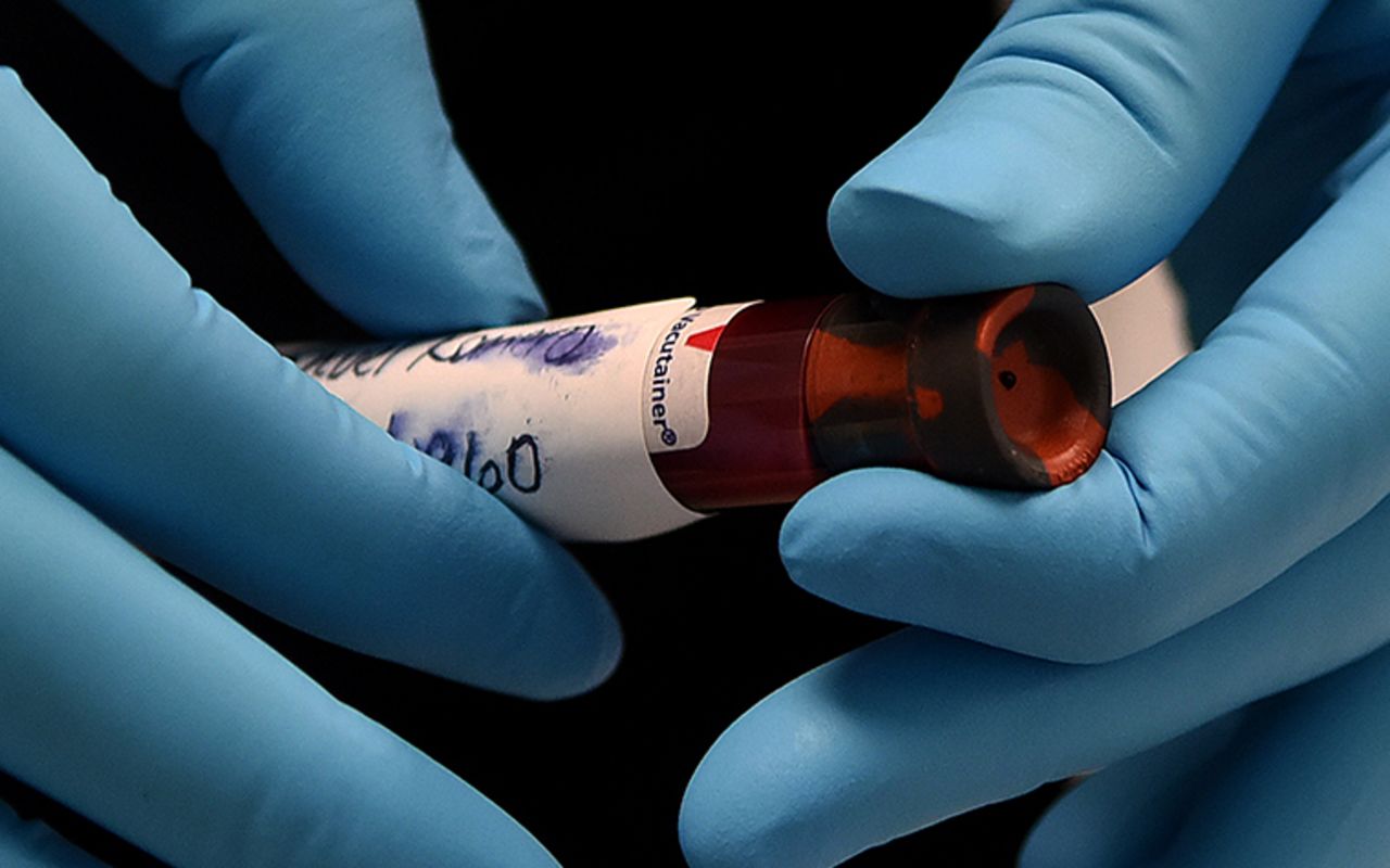  A health worker handles a blood sample on the first day of a free COVID-19 antibody testing event at the Volusia County Fairgrounds in DeLand, Florida on May 4. 