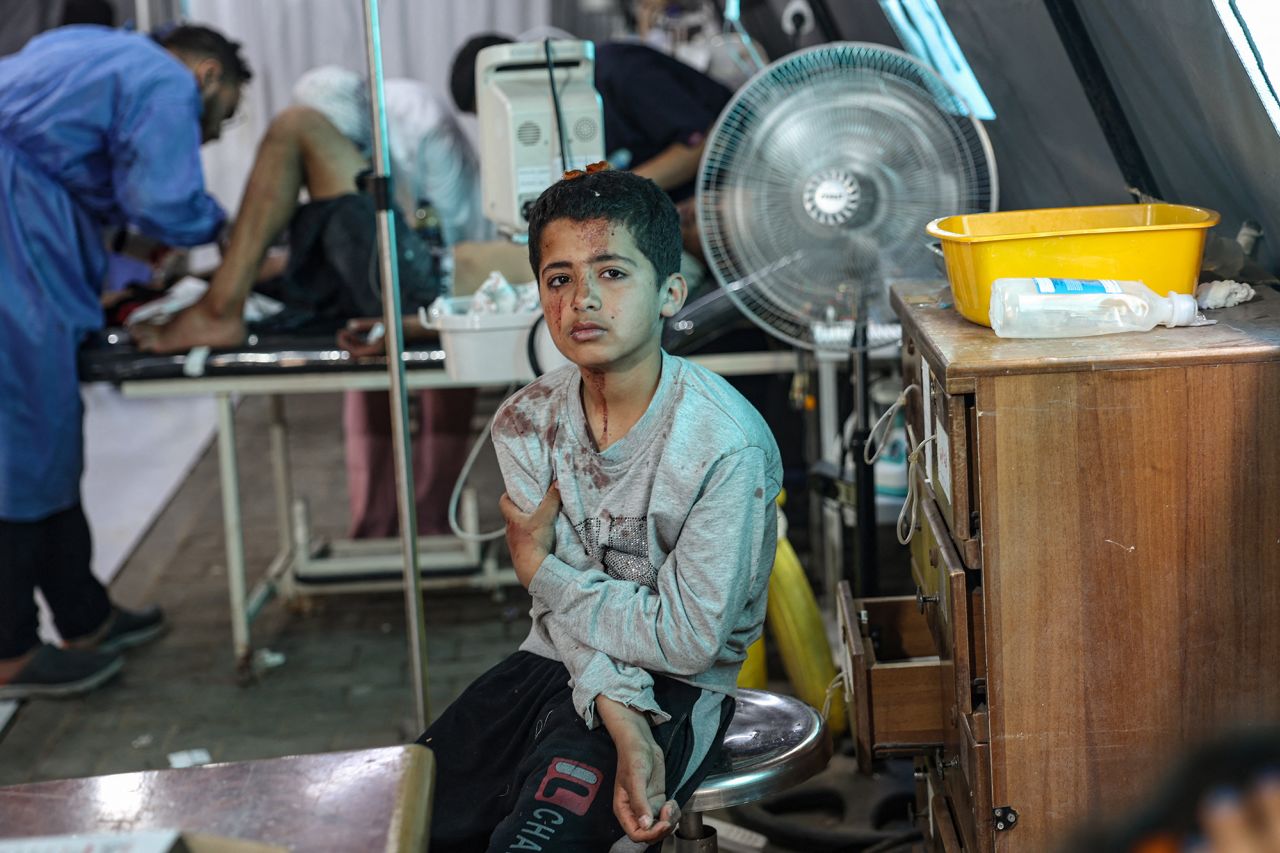 An injured Palestinian boy awaits treatment at the Kuwaiti hospital following Israeli strikes in Rafah, Gaza, on May 7.