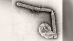 Transmission electron microscopic image of two Influenza A (H5N1) virions, a type of bird flu virus Note the glycoprotein spikes along the surface of the virion and as a stippled appearance of the viral envelope encasing each virion.