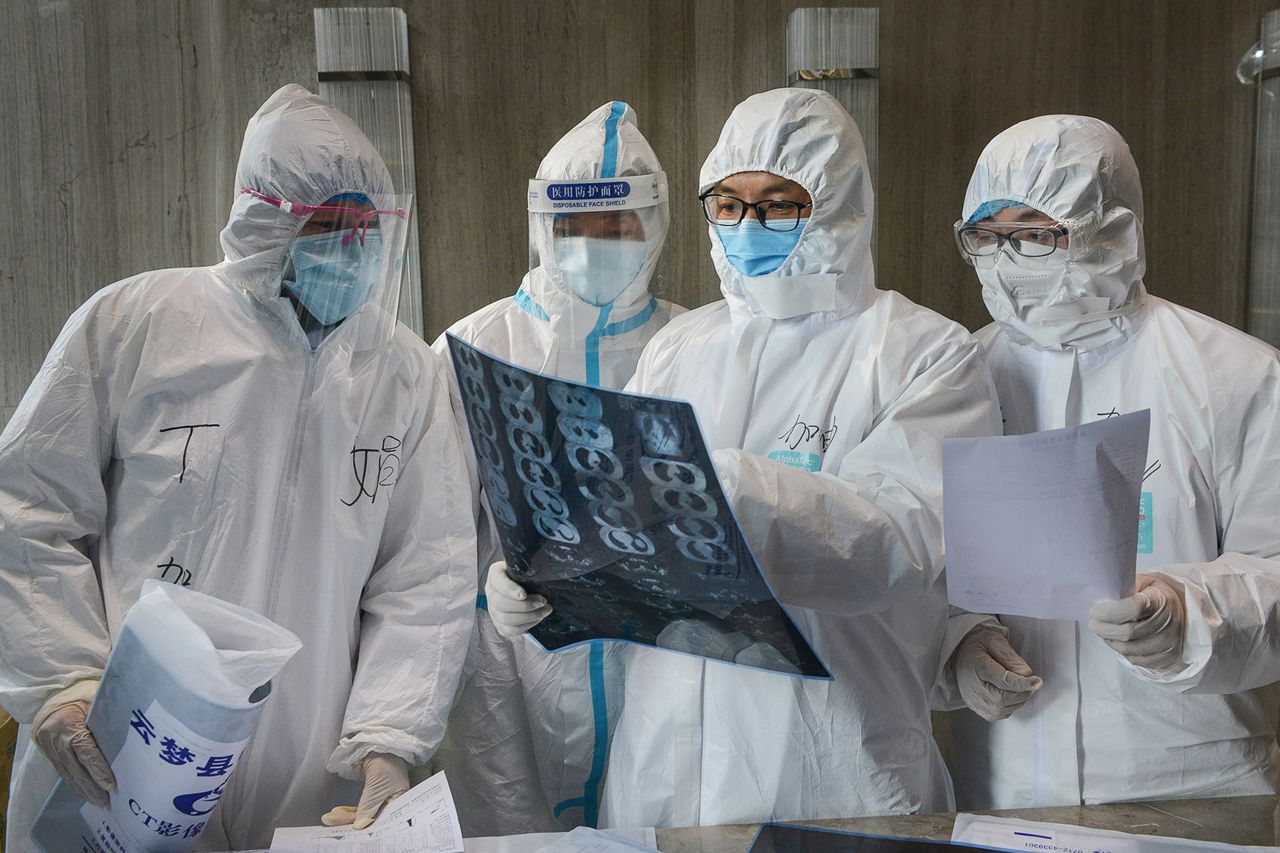 Doctors look at a lung CT image at a hospital in Yunmeng county, Xiaogan city, in China's central Hubei province.