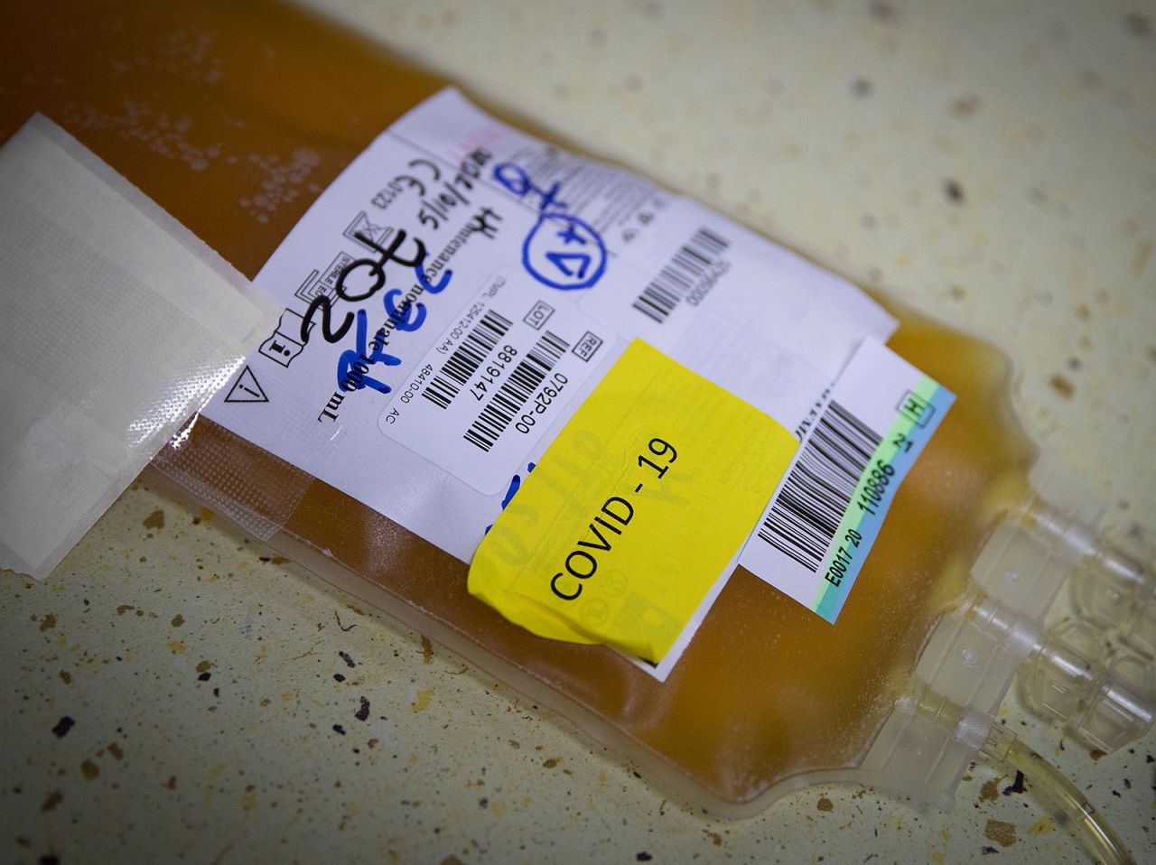 A bag of blood plasma from a donor who has recovered from Covid-19 is seen at The Blood and Tissue Bank Foundation in Palma de Mallorca, Spain on October 5.