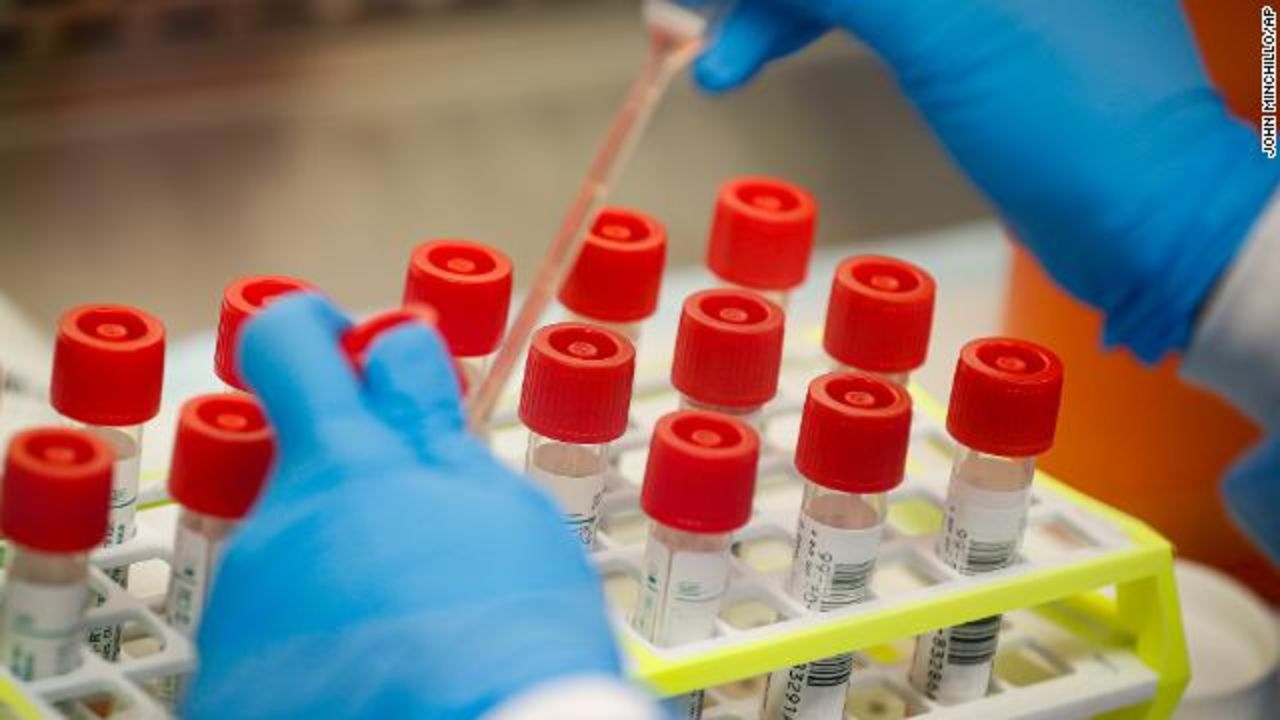 A lab technician prepares coronavirus patient samples for semi-automatic testing at Northwell Health Labs, Wednesday, March 11, in Lake Success, New York. 