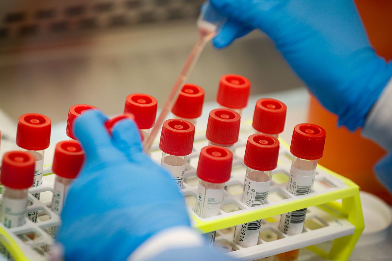 A technician prepares samples for coronavirus testing at a laboratory in Long Island, New York.