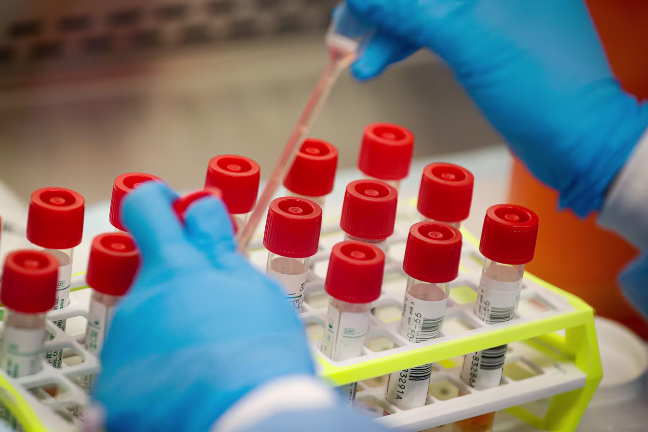A technician prepares samples for coronavirus testing at a laboratory in Long Island, New York.