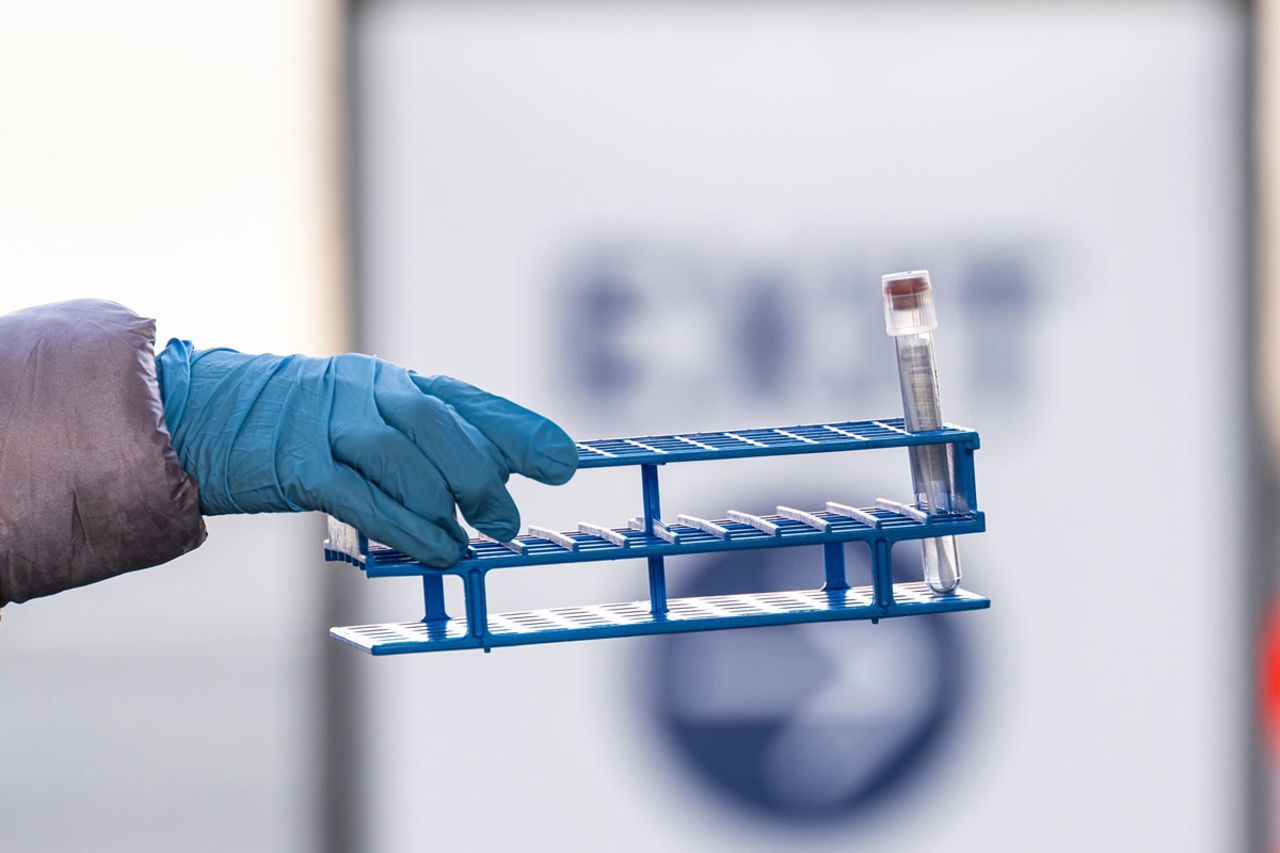 A health care worker collects a Covid-19 swab test at a United Airlines drive-thru testing site inside San Francisco International Airport on January 9.