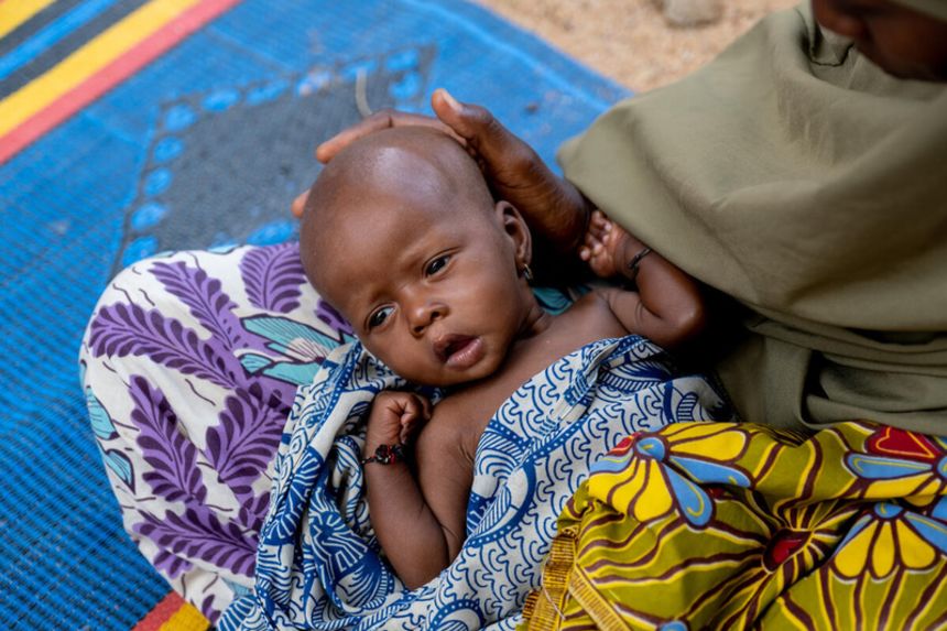 The six-month-old baby suffering from severe acute malnutrition is maintained by his mother at the Kachalabrari Primary Health Care Centre in Dumboa, Borno State, Nigeria.