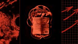 Abortion-Deaths-Transfusions-Lead_preview_maxWidth_3000_maxHeight_3000_ppi_72_embedColorProfile_true_quality_95.jpg