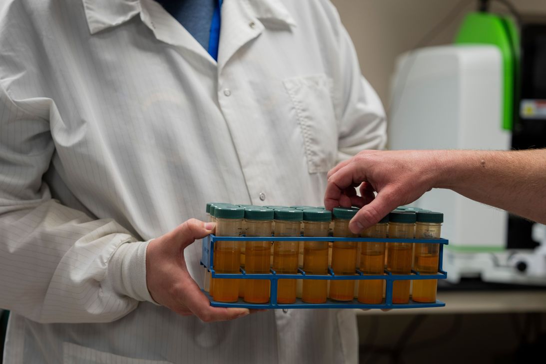 Chemist Jeremiah Erickson holds vials of dissolved lead swabs at the City of Milwaukee Health Department. Swabs are one way investigators check surfaces in buildings for lead.