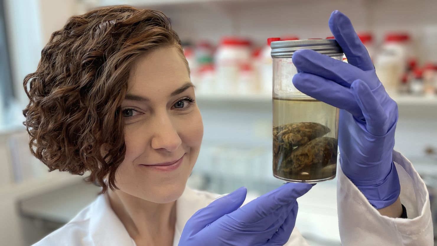 Alexandra Morton-Hayward, a forensic anthropologist and doctoral candidate at the University of Oxford, holds two cerebellar hemispheres of a 200 year-old brain, preserved in formalin.