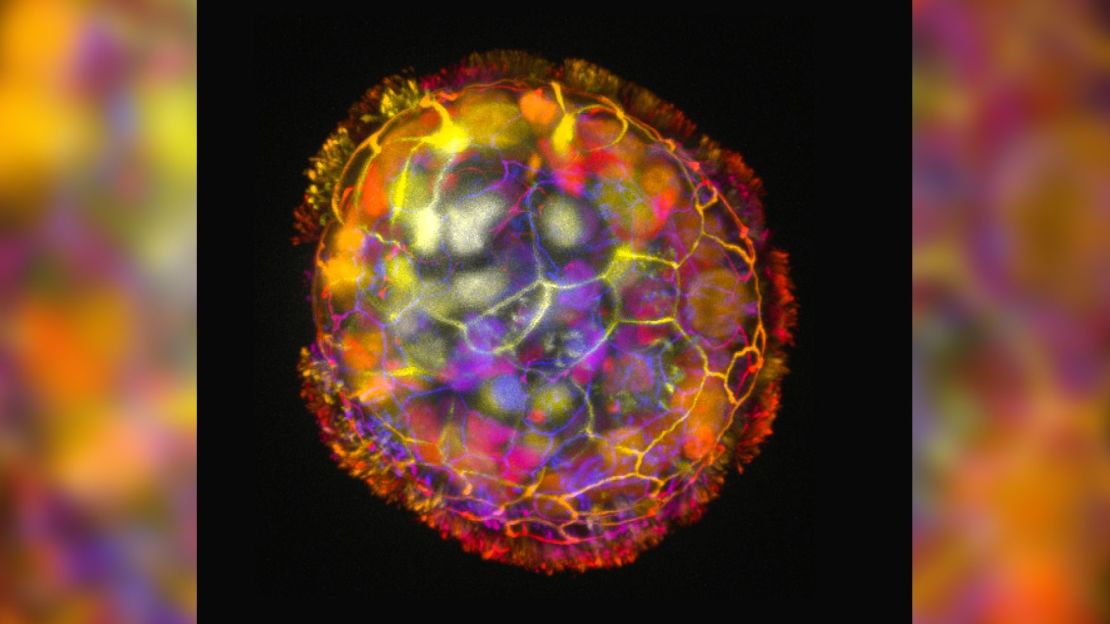A colored image shows the multicellular structure of an anthrobot. Its surface cilia enables it to move and explore its environment.
