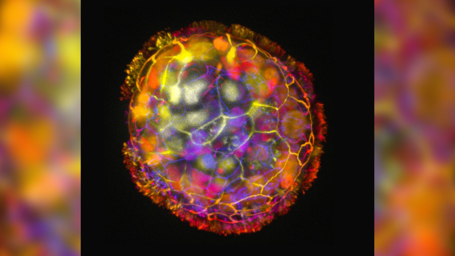 A colored image shows the multicellular structure of an anthrobot, surrounded by cilia on its surface, enabling it to move and explore its environment.