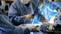 FILE - In this Jan. 17, 2018, file photo, a transplant surgeon holds the kidney from a donor during surgery in St. Louis. America’s transplant system is run by a network of government contractors that do the tough job of collecting organs from deceased donors. Those groups are under fire for letting potentially usable organs go to waste. (Laurie Skrivan/St. Louis Post-Dispatch via AP, File)